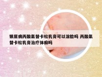 银屑病丙酸氟替卡松乳膏可以涂脸吗 丙酸氟替卡松乳膏治疗体癣吗