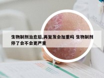 生物制剂治愈后,再复发会加重吗 生物制剂停了会不会更严重