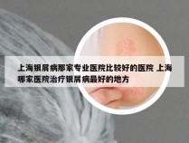 上海银屑病那家专业医院比较好的医院 上海哪家医院治疗银屑病最好的地方