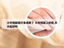 小时候腿碰烂变成癣了 小时候腿上的疤,长大能好吗