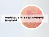 银屑病类克打了2年 银屑病打针一针可以控制十几年的吗