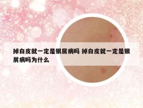 掉白皮就一定是银屑病吗 掉白皮就一定是银屑病吗为什么