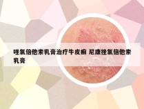 唑氯倍他索乳膏治疗牛皮癣 尼康挫氯倍他索乳膏