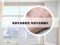 电商牛皮癣意思 淘宝牛皮廨图片