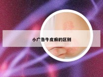 小广告牛皮癣的区别