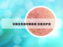 乐银洗发液对银屑病 乐银洗护液