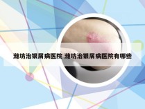 潍坊治银屑病医院 潍坊治银屑病医院有哪些
