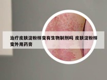 治疗皮肤淀粉样变有生物制剂吗 皮肤淀粉样变外用药膏