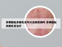 多磺酸粘多糖乳膏可以治银屑病吗 多磺酸粘多糖乳膏治疗