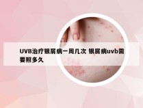 UVB治疗银屑病一周几次 银屑病uvb需要照多久