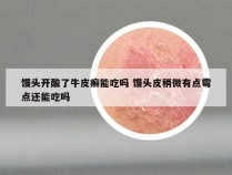 馒头开酸了牛皮癣能吃吗 馒头皮稍微有点霉点还能吃吗