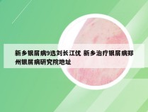 新乡银屑病9选刘长江优 新乡治疗银屑病郑州银屑病研究院地址