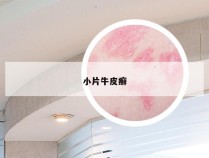 小片牛皮癣