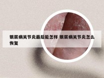银屑病关节炎最后能怎样 银屑病关节炎怎么恢复