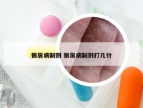 银屑病制剂 银屑病制剂打几针