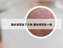 额头突然白了几块 额头突然白一块