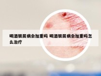 喝酒银屑病会加重吗 喝酒银屑病会加重吗怎么治疗