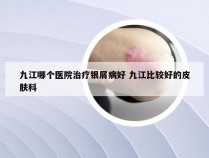 九江哪个医院治疗银屑病好 九江比较好的皮肤科