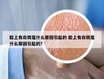 脸上有白斑是什么原因引起的 脸上有白斑是什么原因引起的?