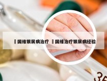 禤国维银屑病治疗 禤国维治疗银屑病经验