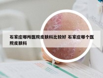 石家庄哪所医院皮肤科比较好 石家庄哪个医院皮肤科