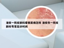 淮安一院皮肤科看银屑病怎样 淮安市一院皮肤科专家出诊时间