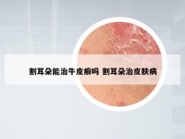 割耳朵能治牛皮癣吗 割耳朵治皮肤病