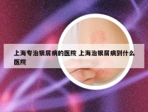 上海专治银屑病的医院 上海治银屑病到什么医院