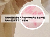 曲安奈德益康唑乳膏治疗银屑病越来越严重 曲安奈德溶液治疗银屑病