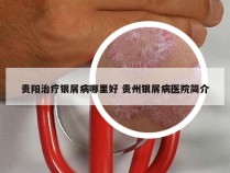 贵阳治疗银屑病哪里好 贵州银屑病医院简介