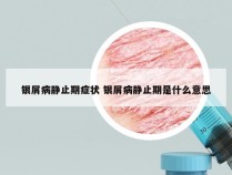 银屑病静止期症状 银屑病静止期是什么意思