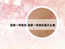 皮肤一块变白 皮肤一块变白是什么病