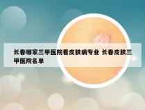 长春哪家三甲医院看皮肤病专业 长春皮肤三甲医院名单
