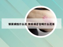 银屑病怕什么花 银屑病适合喝什么花茶