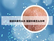 腿部长癣怎么办 腿部长癣怎么办啊