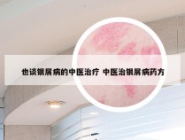 也谈银屑病的中医治疗 中医治银屑病药方