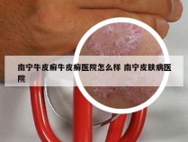 南宁牛皮癣牛皮癣医院怎么样 南宁皮肤病医院