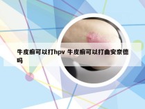 牛皮癣可以打hpv 牛皮癣可以打曲安奈德吗