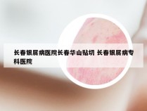 长春银屑病医院长春华山贴切 长春银屑病专科医院