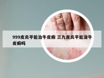 999皮炎平能治牛皮癣 三九皮炎平能涂牛皮癣吗