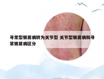 寻常型银屑病转为关节型 关节型银屑病和寻常银屑病区分