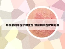 银屑病的中医护理查房 银屑病中医护理方案