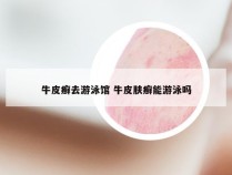 牛皮癣去游泳馆 牛皮肤癣能游泳吗