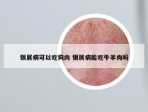 银屑病可以吃狗肉 银屑病能吃牛羊肉吗