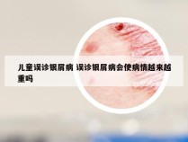 儿童误诊银屑病 误诊银屑病会使病情越来越重吗