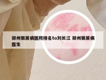 郑州银屑病医院排名to刘长江 郑州银屑病医生