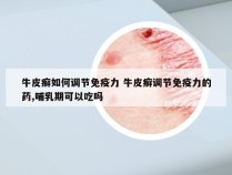 牛皮癣如何调节免疫力 牛皮癣调节免疫力的药,哺乳期可以吃吗