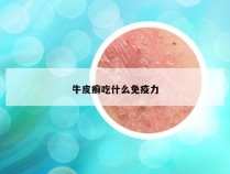 牛皮癣吃什么免疫力