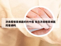 济南看银屑病最好的中医 有在济南银屑病医院看病吗