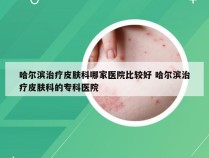 哈尔滨治疗皮肤科哪家医院比较好 哈尔滨治疗皮肤科的专科医院